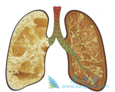 ������ͪ(pirfenex)����Ч���Ʒΰ��������ά���Ľ�չ