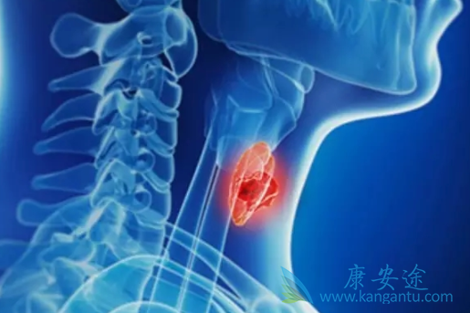 卡博替尼 卡博替尼