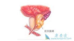 ��������ǰ���ٰ�֢״������Щ