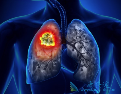 波齐替尼 波齐替尼