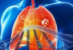 PD-1���Ƽ���PD-L1���Ƽ��ڰ�ȫ������ʲô����