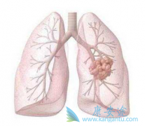 �������ಡ�ķΰ���������̩��ɳ/��ϣ����ǰ���֪ҽ��