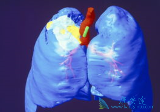 阿法替尼 阿法替尼