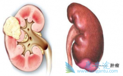 �������������Ʒ�������Щ�����߸����ѡ��