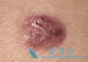 ����ϸ����