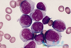 һ�����Ⱥ���˰�Ѫ������Ϊ��Ѫ����Ⱦ��