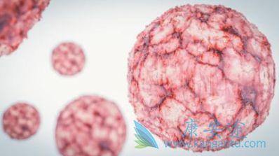 淋巴瘤治疗方法 淋巴瘤治疗方法