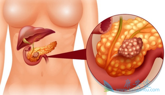 ���ٰ�������