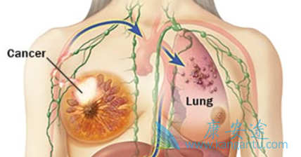 �������ٰ�