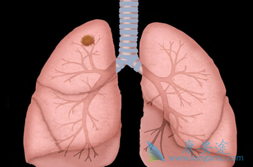 ���Ʒΰ��ķ���