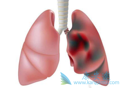 �ΰ�������