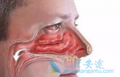 ��PD-1/PD-L1���߼���Ϊ����������ҩ��ı��˱��ʰ����ƾ���