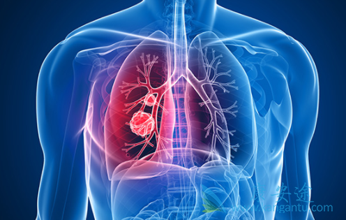 ӡ�����޿�