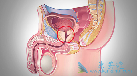 ǰ���ٰ�����