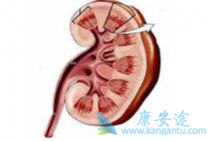 �������ὺ��(Cometriq)�����������ı�׼����ҩ�����Ч