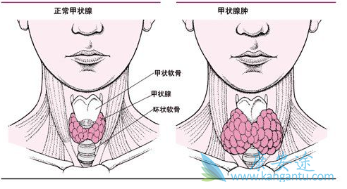 RET�ں�����