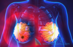 ��������(neratinib)��ʹ���ٰ����ߵ����������½�34%