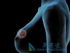 ������������������ĸ�����HER2�������ٰ�Ч����