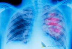 �����������ƽ�չ�Ļ��߿��Ըĳ���������(Lorlatinib)