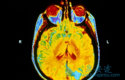 劳拉替尼 劳拉替尼