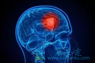 �ΰ���ת��