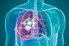 �ΰ����߷��ò�������(Poziotinib)��������Щ������Ӧ