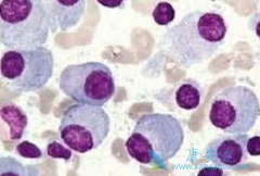 ����ŵ��(Vorinostat)����ǿ�������׶Զ෢�Թ�����������Ч����