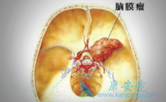 ĿǰNCCN�Ƽ�Ӧ������Ĥ�����Ƶ�ҩ������Щ