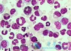 ƶѪ�ͷ�����Ⱦ������ϸ����Ѫ���ĳ���֢״