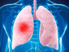 ��ϣ�����������EGFRͻ���ͷ�Сϸ���ΰ�ʱӦע��ʲô