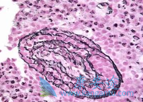 ����Ī����