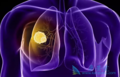 �ΰ���ת�ƻ�����ν��ΰ����ƺ�ҩ�����Ϸ�������