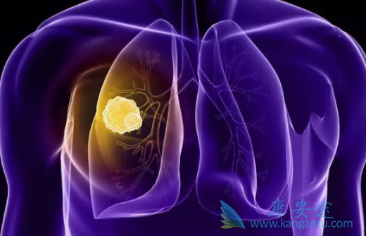 �ΰ�����