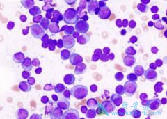 ���ֲ�����Ӧʱ�෢�Թ��������߸���ε��������Ȱ��ķ��ü���