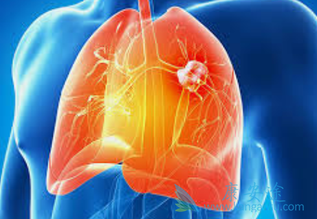 ��Сϸ���ΰ�