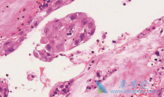 ������Ƥ�ʰ��������Ƴ�����̹��Ԥ����������