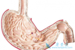 �Զ�������/������ɼ��Ϊ������FLOT���������θ�����ߵ�������