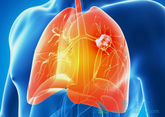 ��������(vandetanib)���ٴ������г�������Щ������Ӧ��