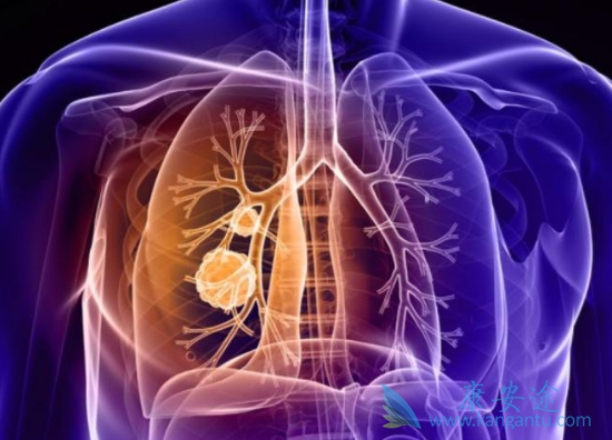 �ΰ�������