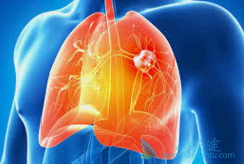 �����鵥��