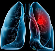 TMB����10�ķΰ�������ѡ���䵥��������ƥľ����