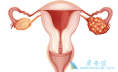 BRCAͻ������������(ZEJULA)���ƻ������������