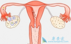 �ѳ������߷���³������(Rucaparib)�������Щ������Ӧ