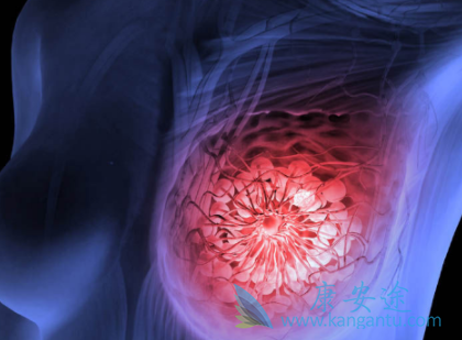 乳腺癌 乳腺癌