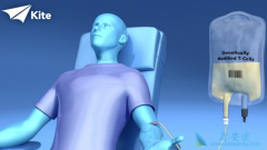 CAR-T�Ʒ�����Ҫ��������ϸ�������ͷ��ۺ���