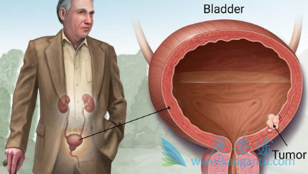 ���װ�����