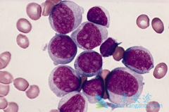 ��Щ����ͻ�����͵İ�Ѫ�����߶���³�����������ǿ��