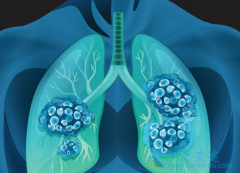 �����������Ͼֲ����ƿɼ��ٷ�Сϸ���ΰ������·���ת�Ʋ���