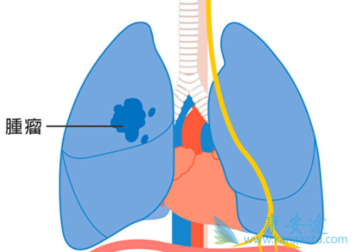 ��Сϸ���ΰ�