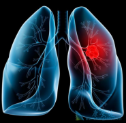 �����������ƿ������ڷΰ����ߵ����������½�32%